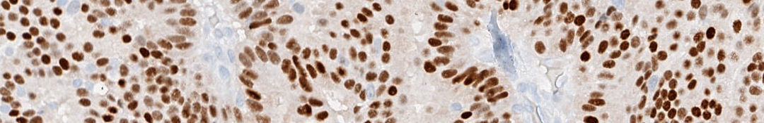 Oncology